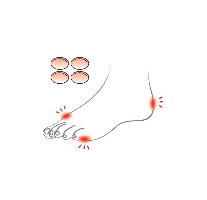 14 ضربه گیر سیلیکونی پا OTESSY - Image 1